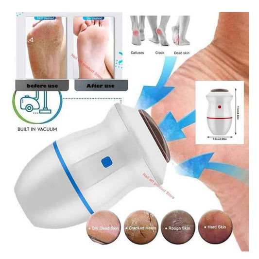 Back Callus Remover with Built-In Vacuum – Electric Foot Grinder for Dead Skin, Cracked Heels & Calluses | Rechargeable Pedicure Tool